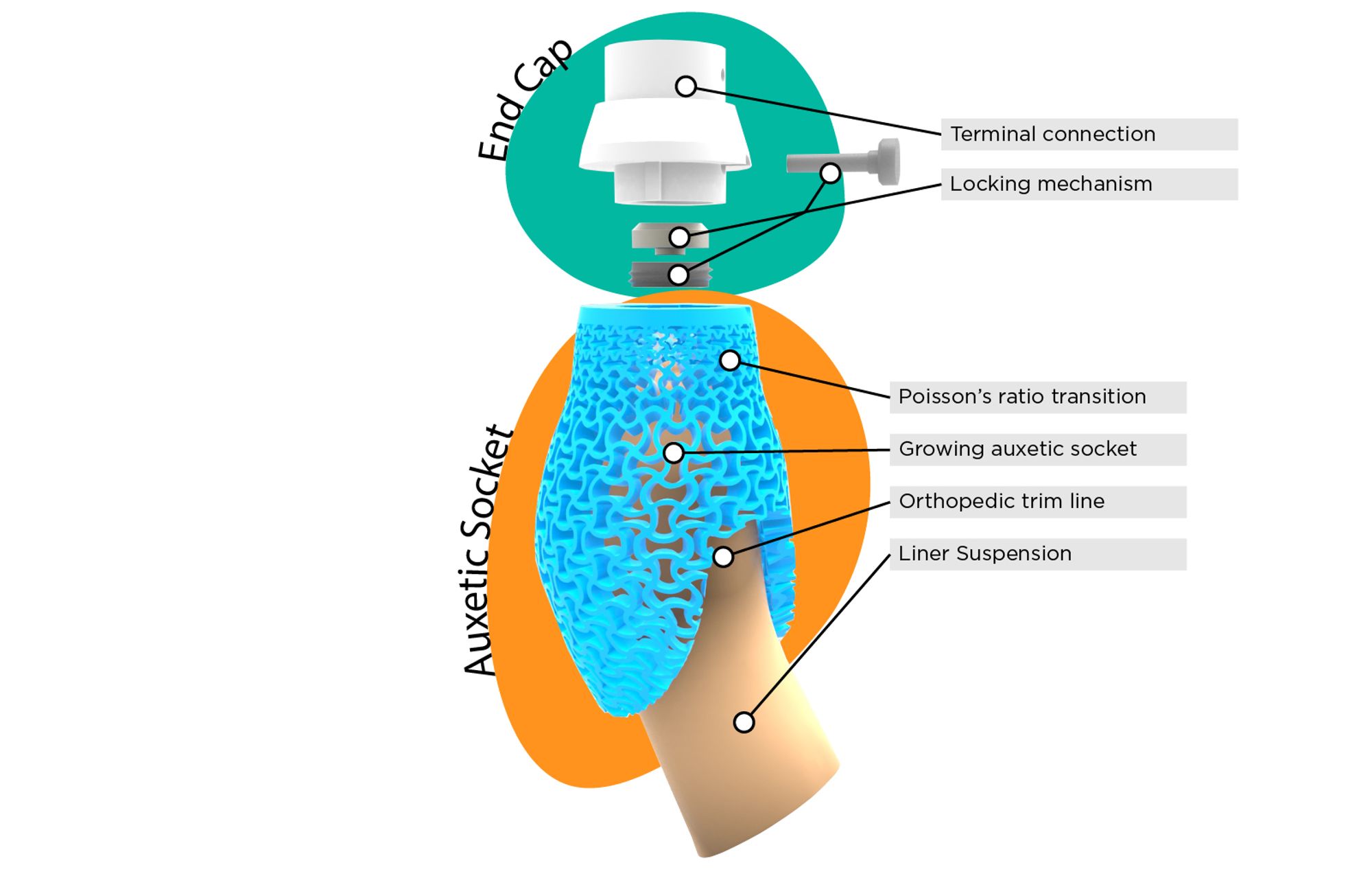 3d_printed_prosthetic_socket.jpg