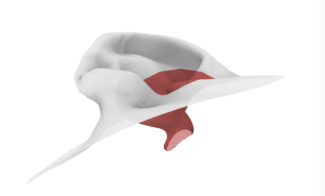 ../../../../_images/ear_boolean.png
