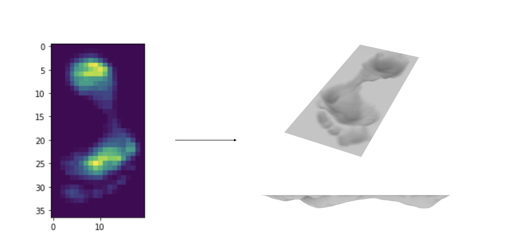Case study of using foot pressure data to drive the design of a shoe sole